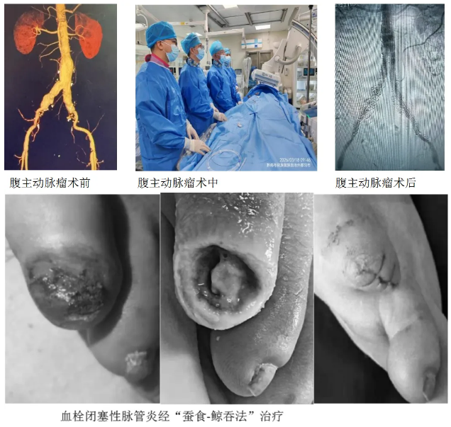 QQ20260610-152452.png