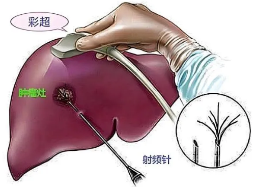 QQ20260610-085600.png