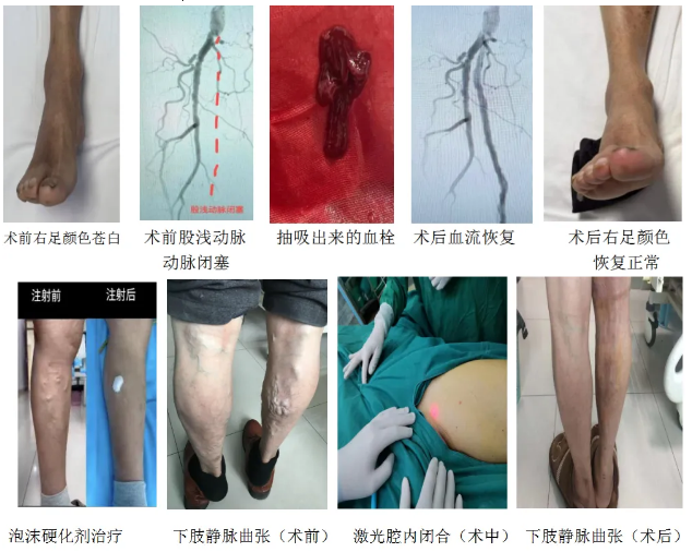 QQ20260610-152442.png